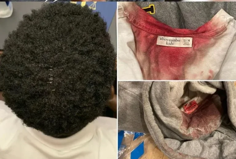 Football coach accused of sm@shing 14 year old student’s head into wall so many times his skull had to be stitched