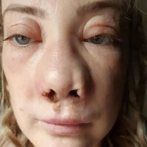 botched surgery