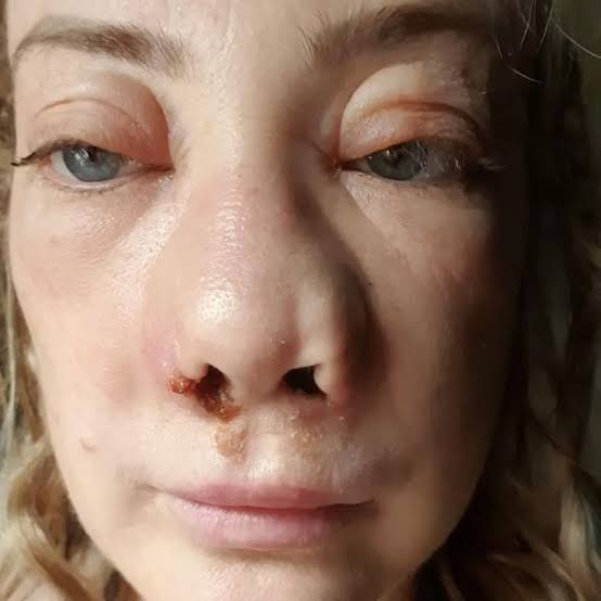 botched surgery