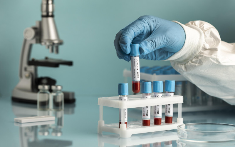 Testing Medical Innovations on Ground in Nigeria: Bringing Parkinson’s Care Closer to Home